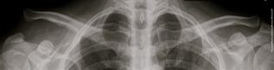 X-Ray