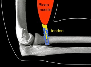 Rotator Cuff Repair, NSW Australia