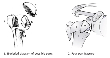 Bones of Shoulder