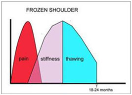 Frozen Shoulder