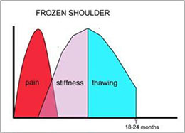 Frozen Shoulder