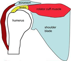 Rotator Cut Tear