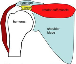 Rotator Cut Tear