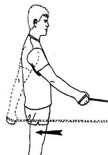 Shoulder Pyrocarbon Hemiarthroplasty