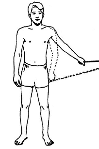 Shoulder Pyrocarbon Hemiarthroplasty